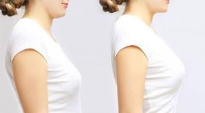 تجنب تهدل الثديين إذا كنت سيدة صغيرة صورة: تجنب تهدل الثديين إذا كنت سيدة صغيرة