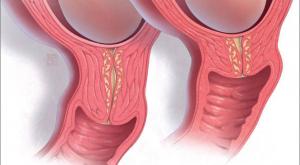 صورة: قياس طول قاع رحم الحامل