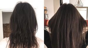 صورة: إعادة نمو الشعر بعد تساقطه للنساء