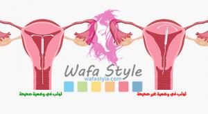 صورة: إخراج لولب من الرحم