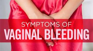 صورة: وقف النزيف المهبلي