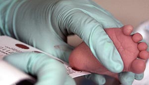 صورة: ما هو فحص الكعب لحديثي الولادة