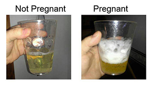 صورة: اسباب تفاعل البول مع الكلور