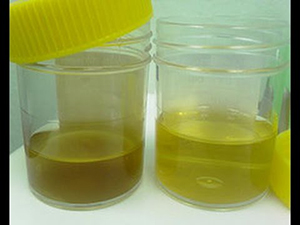 صورة: طريقة اختبار الحمل بالزيت