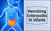 التهاب الأمعاء الناخر عند الرضع