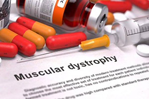 7 أعراض خطيرة من ضمور العضلات في الأطفال صورة: 7 أعراض خطيرة من ضمور العضلات في الأطفال