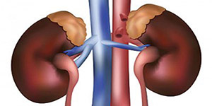 اضرار الارتجاع البولي المثاني الحالبي عند الأطفال صورة: اضرار الارتجاع البولي المثاني الحالبي عند الأطفال