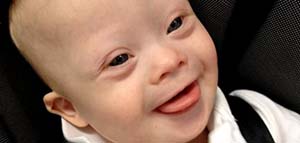 الطفل المنغولي وكيفية التعامل معه صورة: الطفل المنغولي وكيفية التعامل معه