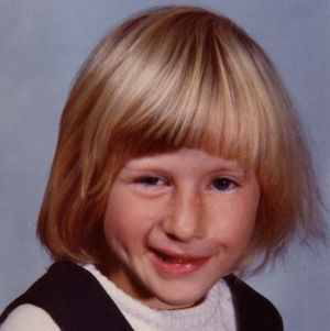 أعراض ألتهاب العصب السابع عند الأطفال صورة: أعراض ألتهاب العصب السابع عند الأطفال