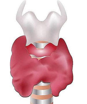 أسباب قصور الدرق عند الرضيع صورة: أسباب قصور الدرق عند الرضيع