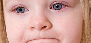 كيف تحدث الأصابة بمرض الرمد الربيعي لدى الأطفال صورة: كيف تحدث الأصابة بمرض الرمد الربيعي لدى الأطفال