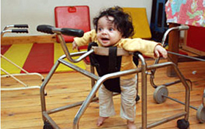 تعرفي على مرض شلل الأطفال صورة: تعرفي على مرض شلل الأطفال