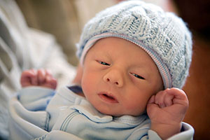 صورة: التثلث الصبغي Trisomy وأنواعه