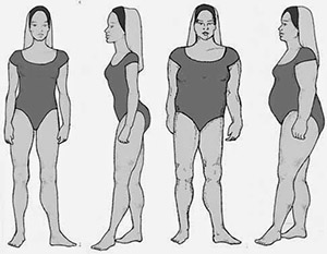 رجيم الجسم الكظري صورة: رجيم الجسم الكظري