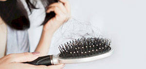 طُرُق علاج تساقط الشعر: طبيعية وطبِّية ونصائح مفيدة صورة: طُرُق علاج تساقط الشعر: طبيعية وطبِّية ونصائح مفيدة