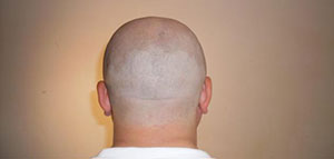 فوائد حلاقة الشعر بالموس ونصائح للاستخدام صورة: فوائد حلاقة الشعر بالموس ونصائح للاستخدام