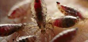 الصيبان و أسباب الصيبان و أعراض الصيبان صورة: الصيبان و أسباب الصيبان و أعراض الصيبان