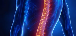 صورة: العمود الفقري و تشوهات العمود الفقري