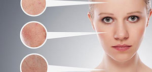 صورة: العناية بالبشرة الدهنية: نصائح ووصفات منزلية