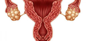 تضخم الرحم و أسباب تضخم الرحم و أعراض تضخم الرحم صورة: تضخم الرحم و أسباب تضخم الرحم و أعراض تضخم الرحم