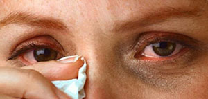 صورة: مرض الرمد الربيعي و الأسباب التي تؤدي إلى مرض الرماد الربيعي