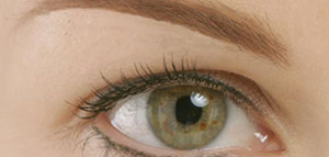 صورة: الهالات السوداء و أسباب ظهور الهالات السوداء