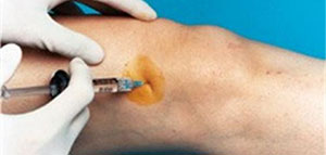 خشونة الركبة و أسباب الإصابة بخشونة الركبة صورة: خشونة الركبة و أسباب الإصابة بخشونة الركبة