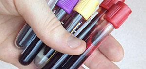 الدم و غازات الدم و فحص غازات الدم صورة: الدم و غازات الدم و فحص غازات الدم