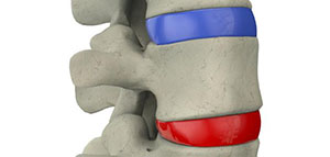 نخاع العظم و خلايا نخاع العظم و أمراض نخاع العظم صورة: نخاع العظم و خلايا نخاع العظم و أمراض نخاع العظم