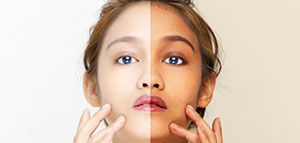 قناع جل الصبار و قناع الطماطم و قناع التبييض صورة: قناع جل الصبار و قناع الطماطم و قناع التبييض