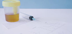 أسباب لون البول الأصفر الطبيعي و أسباب البول الأصفر الفاتح صورة: أسباب لون البول الأصفر الطبيعي و أسباب البول الأصفر الفاتح