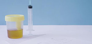 صورة: أسباب تغير لون البول إلى الأصفر الغامق