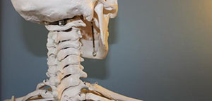 هشاشة العظام و قلة النسيج العظمي و تلين العظام صورة: هشاشة العظام و قلة النسيج العظمي و تلين العظام