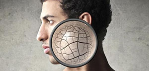 البشرة الجافة و العناية المنزلية بالبشرة الجافة صورة: البشرة الجافة و العناية المنزلية بالبشرة الجافة