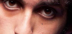 السواد تحت العين و أسباب السواد تحت العين صورة: السواد تحت العين و أسباب السواد تحت العين