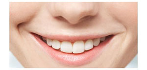 السواد حول الفم و طرق إزالة السواد حول الفم صورة: السواد حول الفم و طرق إزالة السواد حول الفم