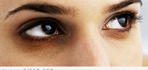 صورة: السواد تحت العين و وصفات طبيعية تخلص من السواد تحت العين