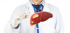 صورة: أعراض مرض الكبد الدهني و أعراض تستدعي مراجعة الطبيب