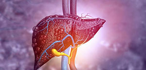 صورة: أسباب ارتفاع إنزيمات الكبد و عوامل خطر ارتفاع إنزيمات الكبد