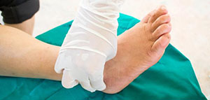 صورة: علاج مرض شاركوت و التعافي من مرض شاركوت