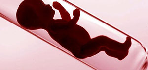 أطفال الأنابيب و علامات نجاح أطفال الأنابيب صورة: أطفال الأنابيب و علامات نجاح أطفال الأنابيب