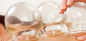 الحجامة و أماكن عمل الحجامة و فوائد الحجامة الجافة للظهر صورة: الحجامة و أماكن عمل الحجامة و فوائد الحجامة الجافة للظهر