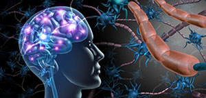 صورة: أعراض هجمات التصلب اللويحي و أسباب مرض التصلب اللويحي