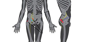 التهاب عرق النسا عند الرجال و أعراض عرق النسا صورة: التهاب عرق النسا عند الرجال و أعراض عرق النسا