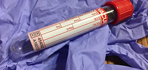 تحليل الدم الكامل و دواعي إجراء تحليل الدم الكامل صورة: تحليل الدم الكامل و دواعي إجراء تحليل الدم الكامل