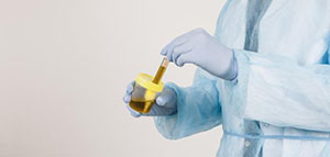 الجفاف و بعض أنواع الطعام والأدوية و أسباب أخرى صورة: الجفاف و بعض أنواع الطعام والأدوية و أسباب أخرى