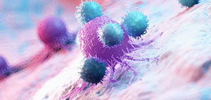 صورة: السرطان النقيلي و أعراض السرطان النقيلي