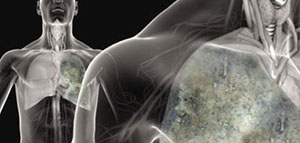 أعراض المياه على الرئة و أعراض تستدعي التدخل الطبي الفوري صورة: أعراض المياه على الرئة و أعراض تستدعي التدخل الطبي الفوري