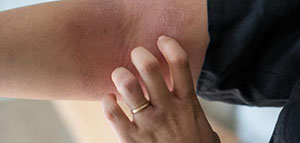 أعراض التحسس من الأدوية و أعراض تستدعي التدخل الطبي صورة: أعراض التحسس من الأدوية و أعراض تستدعي التدخل الطبي