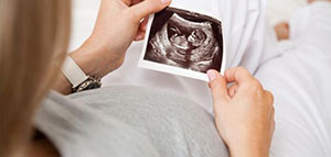 الجنين في الشهر الثاني صورة: الجنين في الشهر الثاني